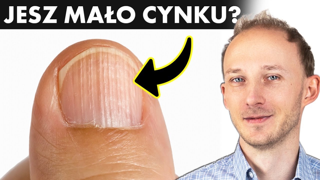 13 oznak, że powinieneś jeść więcej cynku - cynk a zdrowie i dieta | Dr Bartek Kulczyński